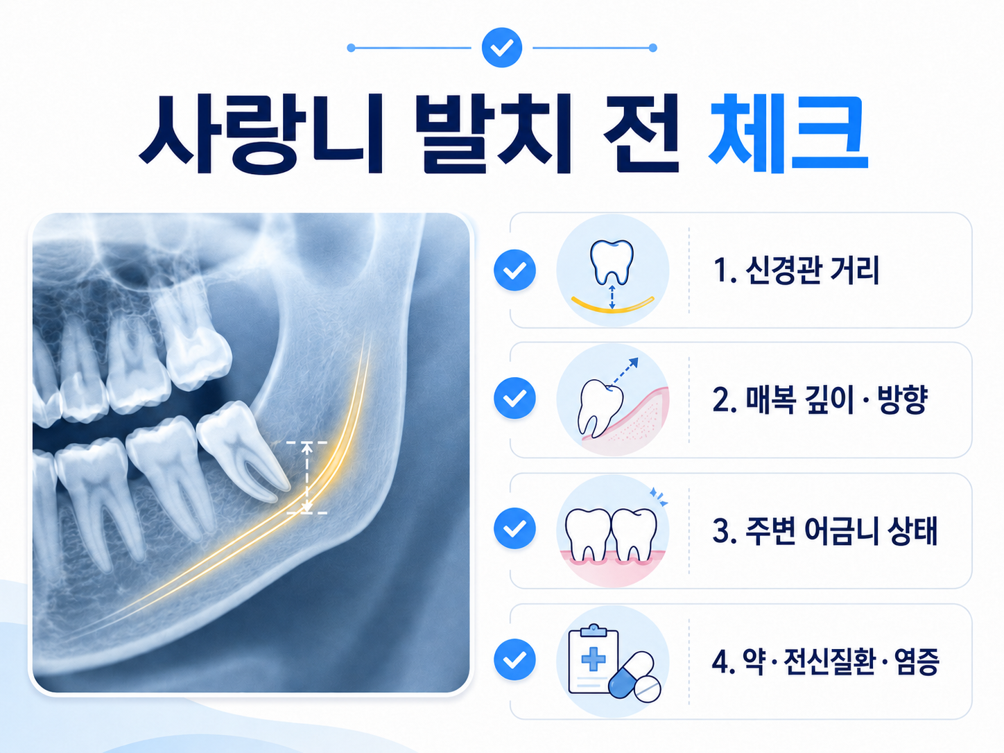사랑니 발치 전 3D CT 진단 이미지