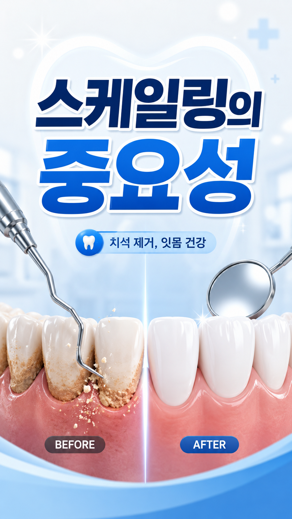 스케일링 및 잇몸 관리 이미지