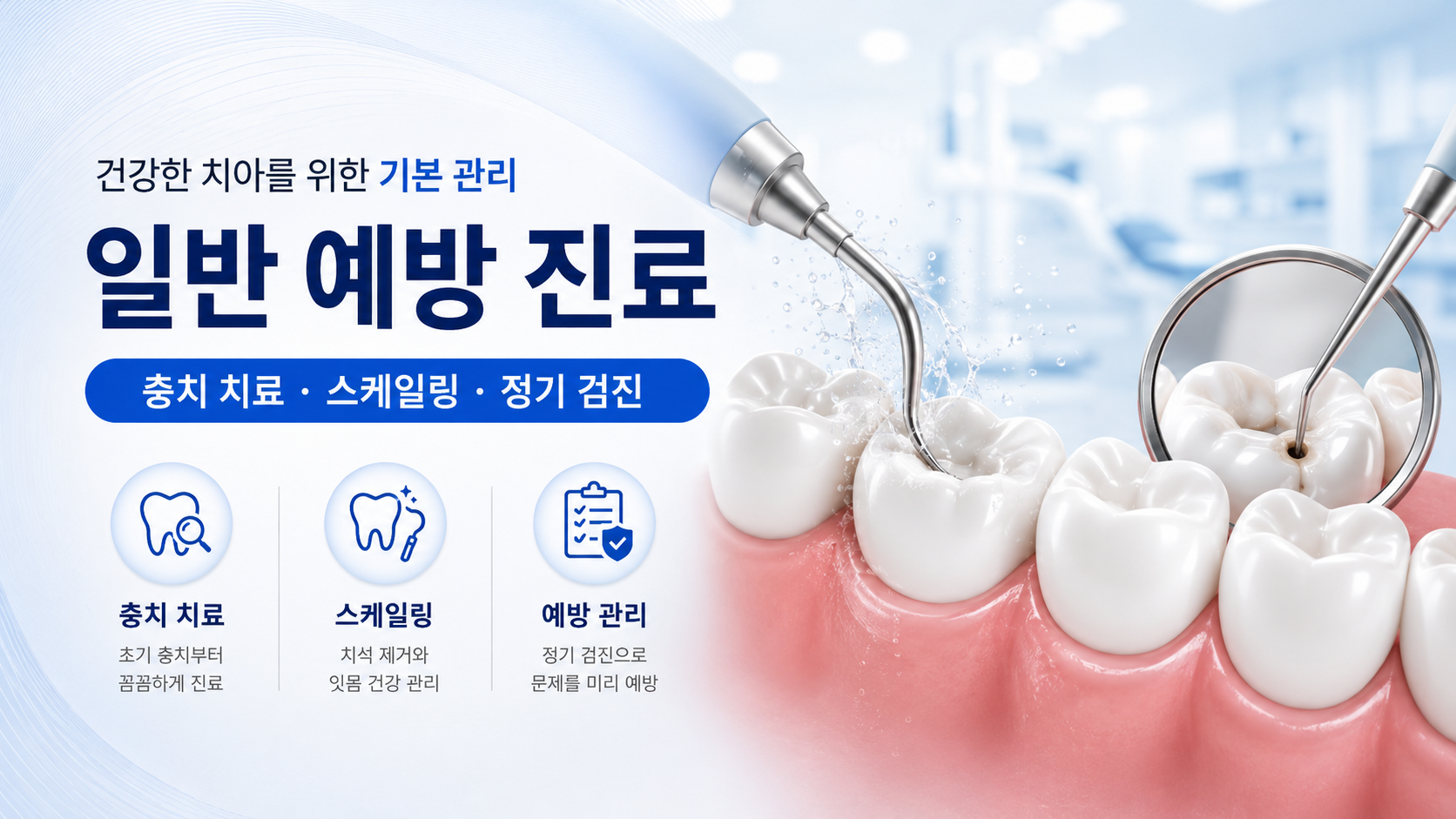 충치치료 스케일링