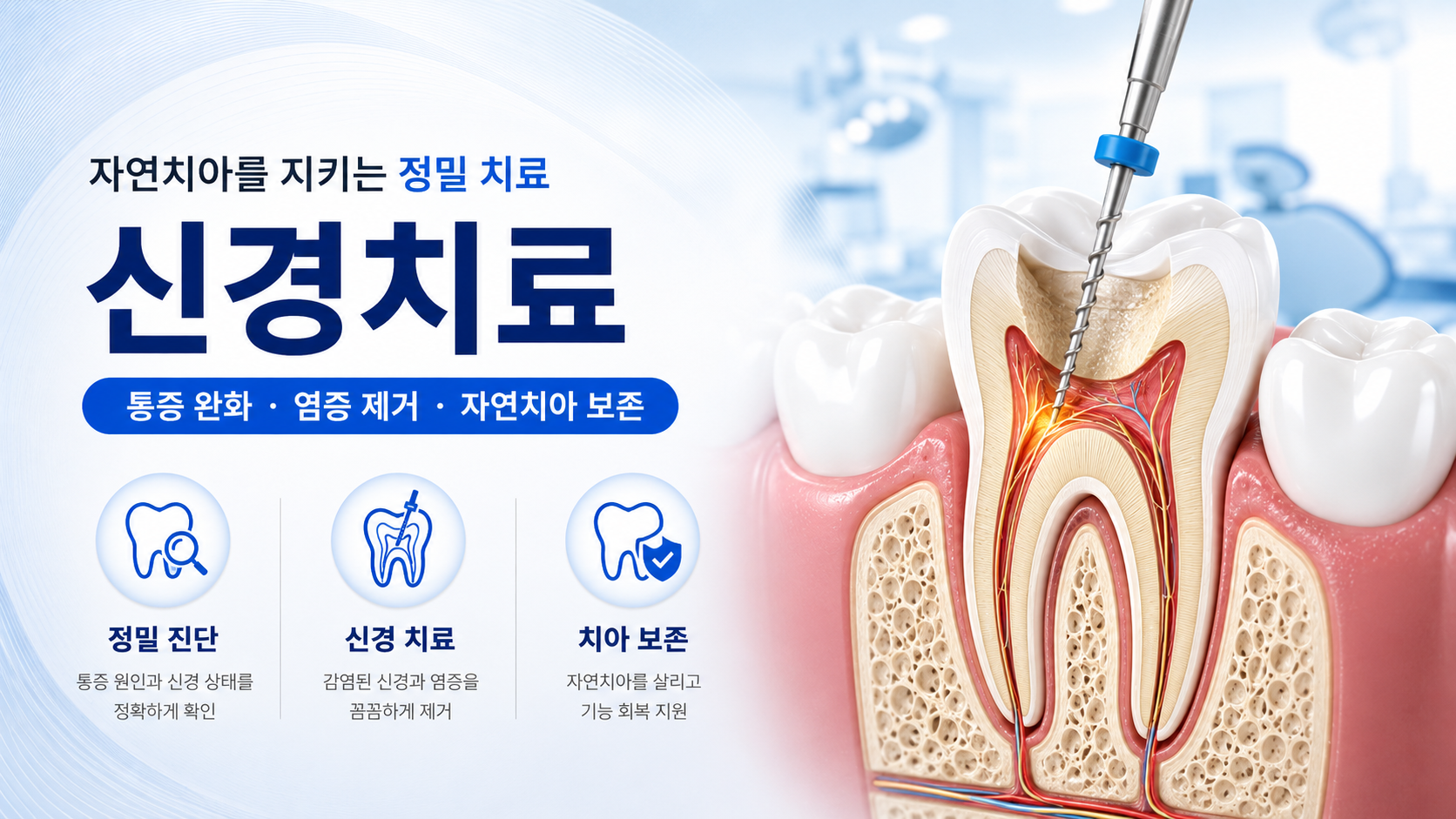 신경치료
