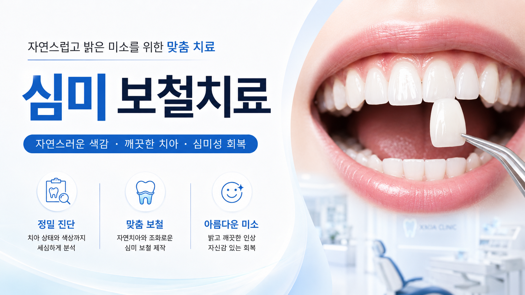 심미, 보철치료