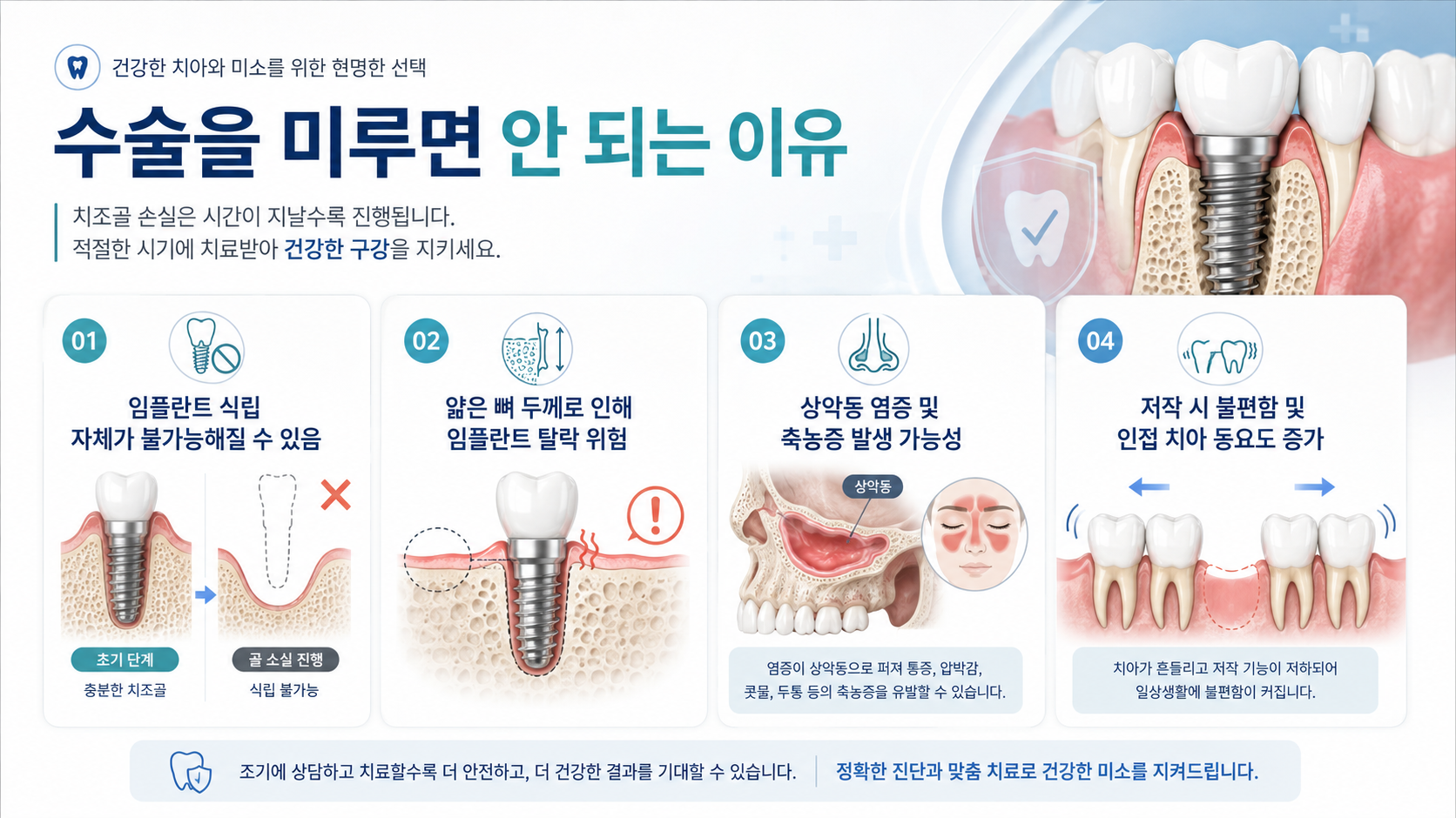 위턱 어금니 상실 후 잇몸뼈 변화 설명 이미지