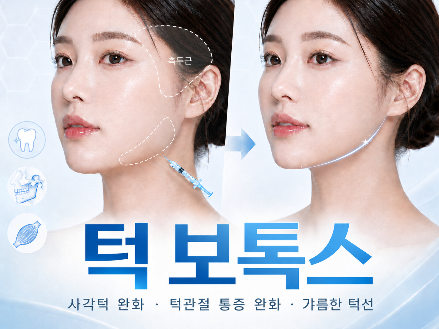 치과 보톡스 상담 및 진료 이미지